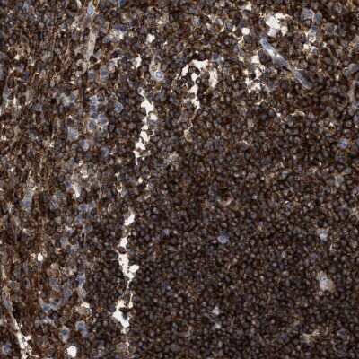 Immunohistochemistry-Paraffin: PTP epsilon Antibody [NBP1-87190] - Staining of human lymph node shows strong cytoplasmic positivity in germinal center cells and non-germinal center cells.
