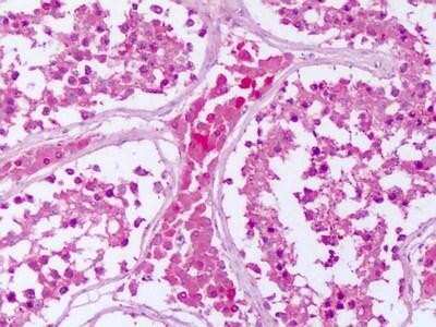 Immunohistochemistry-Paraffin: PTP epsilon Antibody [NLS6799] - Analysis of anti-PTPRE antibody with human testis.