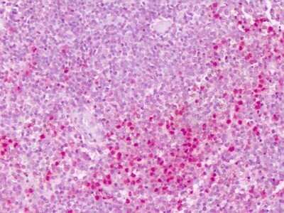 Immunohistochemistry-Paraffin: PTP epsilon Antibody [NLS6799] - Analysis of anti-PTPRE antibody with human spleen at dilution 3-6 ug/ml.