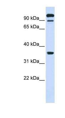 Western Blot: PTP epsilon Antibody [NBP1-62460] - 293T cells lysate, concentration 0.2-1 ug/ml.
