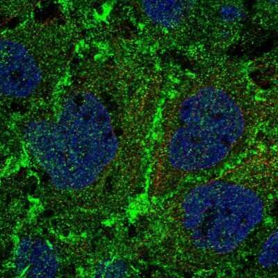Immunocytochemistry/Immunofluorescence: PTP mu/PTPRM Antibody [NBP2-54929] - Staining of human cell line CACO-2 shows localization to plasma membrane.