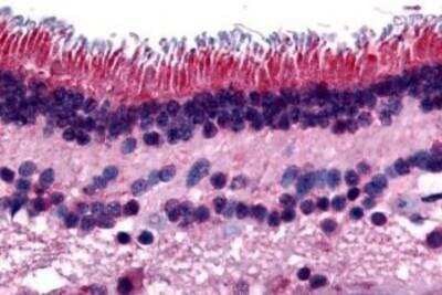 Immunohistochemistry-Paraffin: PTP mu/PTPRM Antibody [NB110-39012] - Analysis of anti-PTPRM antibody with human retina at concentration 16 ug/ml.