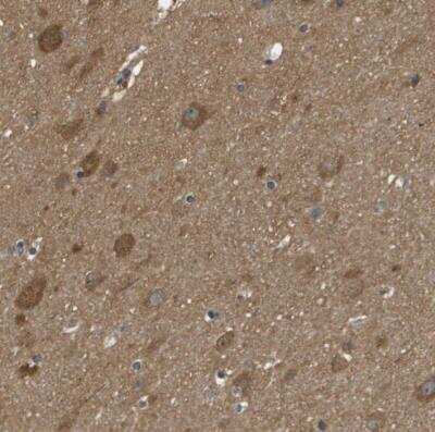 Immunohistochemistry-Paraffin: PTP rho/PTPRT Antibody [NBP1-81524] - Staining of human cerebral cortex shows moderate cytoplasmic positivity in neuronal cells, glial cells and neuropil.
