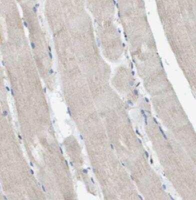 Immunohistochemistry-Paraffin: PTP rho/PTPRT Antibody [NBP1-81524] - Staining of human skeletal muscle shows very weak positivyt in myocytes as expected.