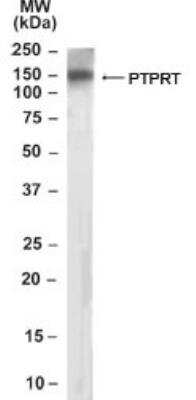 Western Blot: PTP rho/PTPRT Antibody [NB100-1459] -  Analysis of PTPRT in human brain lysate (RIPA buffer, 35 ug total protein per lane) using this antibody at 0.3 ug/ml.