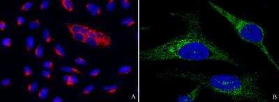 Immunocytochemistry/Immunofluorescence: PTP1B/PTPN1 Antibody (001) [NBP2-89399] - Staining of human PTPN1 in A549 and Hela cells. Cells were fixed with 4% PFA, blocked with 10% serum, and incubated with Rabbit anti-human PTPN1 monoclonal antibody (1:60) at 4c overnight. Then A549 cells were stained with the Alexa Fluor® 549-conjugated Goat Anti-rabbit IgG secondary antibody (figure A, captured by fluorescence microscope); Hela cells were stained with the Alexa Fluor(R) 488-conjugated Goat Anti-rabbit IgG secondary antibody (figure B, captured by laser confocal scanning microscope) , countstained with DAPI (blue). Positive staining was localized to cytoplasm.