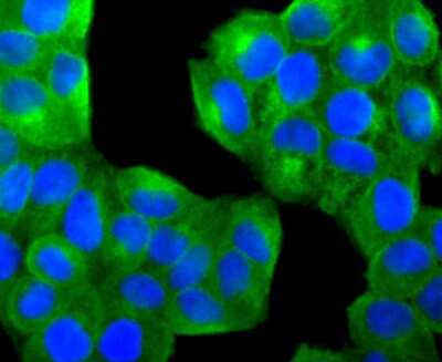 Immunocytochemistry/Immunofluorescence: PTP1B/PTPN1 Antibody (JJ0935) [NBP2-67918] - Staining PTP1B in Hela cells (green). The nuclear counter stain is DAPI (blue). Cells were fixed in paraformaldehyde, permeabilised with 0.25% Triton X100/PBS.