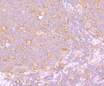 Immunohistochemistry-Paraffin: PTP1B/PTPN1 Antibody (JJ0935) [NBP2-67918] - Analysis of paraffin-embedded human tonsil tissue using anti-PTP1B antibody. Counter stained with hematoxylin.