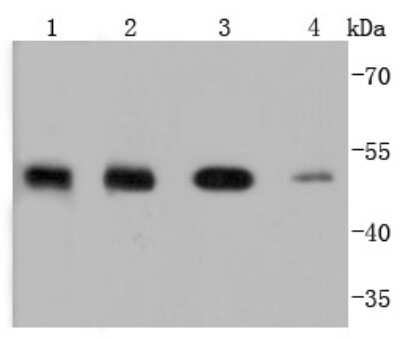 Western Blot: PTP1B/PTPN1 Antibody (JJ0935) [NBP2-67918] - Analysis of PTP1B on different lysates using anti-PTP1B antibody at 1/1,000 dilution. Positive control: Lane 1: zebrafish Lane 2: MCF-7 Lane 3: HepG2 Lane 4: A431