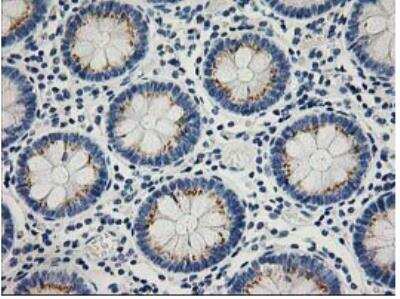 Immunohistochemistry-Paraffin: PTP1B/PTPN1 Antibody (OTI1D10) - Azide and BSA Free [NBP2-73729] - Staining of paraffin-embedded Human colon tissue within the normal limits using anti-PTPN1 mouse monoclonal antibody. (Heat-induced epitope retrieval by 10mM citric buffer, pH6.0, 100C for 10min.