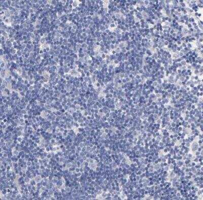 Immunohistochemistry-Paraffin: PTP4A1 Antibody [NBP1-87224] - Staining of human lymph node shows no positivity in non-germinal center cells as expected.