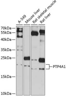 Western Blot: PTP4A1 Antibody [NBP2-93981] - Analysis of extracts of various cell lines, using PTP4A1 at 1:3000 dilution. Secondary antibody: HRP Goat Anti-Rabbit IgG (H+L) at 1:10000 dilution. Lysates/proteins: 25ug per lane. Blocking buffer: 3% nonfat dry milk in TBST. Detection: ECL Basic Kit . Exposure time: 90s.