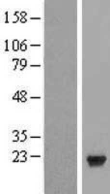 Western Blot: PTP4A1 Overexpression Lysate (Adult Normal) [NBL1-14959] Left-Empty vector transfected control cell lysate (HEK293 cell lysate); Right -Over-expression Lysate for PTP4A1.