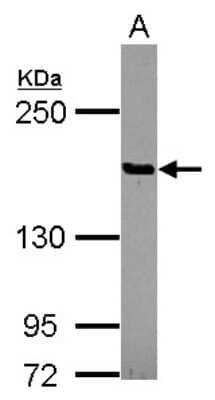 Western Blot: PTPD2 Antibody [NBP2-15070] - Sample (30 ug of whole cell lysate) A: 293T 5% SDS PAGE; antibody diluted at 1:1000.