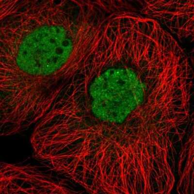 Immunocytochemistry/Immunofluorescence: PTPDC1 Antibody [NBP1-81950] - Immunofluorescent staining of human cell line A-431 shows localization to nucleoplasm.