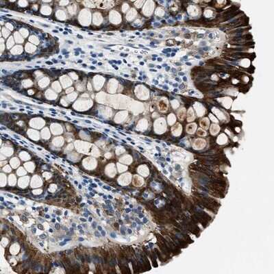 Immunohistochemistry-Paraffin: PTPDC1 Antibody [NBP1-81950] - Staining of human rectum shows strong cytoplasmic positivity in glandular cells.