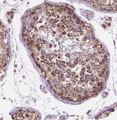 Immunohistochemistry-Paraffin: PTPIP51 Antibody [NBP1-84738] - Staining of human testis shows strong cytoplasmic granular positivity in cells in seminiferous ducts.