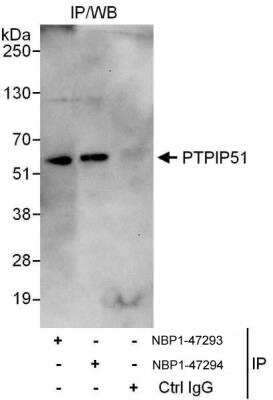 Immunoprecipitation: PTPIP51 Antibody [NBP1-47293] - Samples: Whole cell lysate (1 mg for IP, 20% of IP loaded) from HeLa cells.   Antibodies: Affinity purified rabbit anti-PTPIP51 antibody NBP1-47293 used for IP at 3 ug/mg lysate.  PTPIP51 was also immunoprecipitated by rabbit anti-PTPIP51 antibody NBP1-47294, which recognizes a downstream epitope.  For blotting immunoprecipitated PTPIP51, NBP1-47294 was used at 1 ug/ml.   Detection: Chemiluminescence with an exposure time of 30 seconds.
