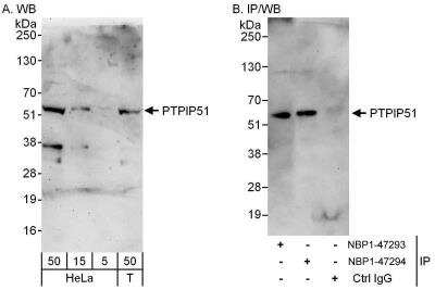 Immunoprecipitation: PTPIP51 Antibody [NBP1-47294] - Samples:  Whole cell lysate from HeLa (5, 15 and 50 ug for WB; 1 mg for IP, 20% of IP loaded) and 293T (T; 50 ug) cells.   Antibodies: Affinity purified rabbit anti-PTPIP51 antibody NBP1-47294 used for WB at 0.1 ug/ml (A) and 1 ug/ml (B) and used for IP at 3 ug/mg lysate.  PTPIP51 was also immunoprecipitated by rabbit anti-PTPIP51 antibody NBP1-47293, which recognizes an upstream epitope.   Detection: Chemiluminescence with exposure times of 3 minutes (A) and 30 seconds (B).