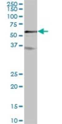 Western Blot: PTPIP51 Antibody [H00055177-B01P] - Analysis of FAM82C expression in human liver.