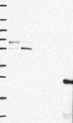 Western Blot: PTPIP51 Antibody [NBP3-17917] - Lane 1: Marker [kDa] 250, 130, 95, 72, 55, 36, 28, 17, 10;   Lane 2: RT4;   Lane 3: U-251 MG;   Lane 4: Human Plasma;   Lane 5: Liver;   Lane 6: Tonsil