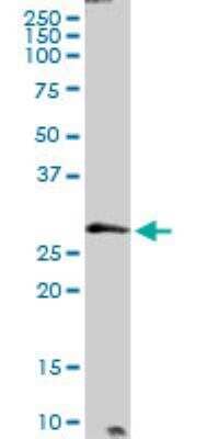 Western Blot PTPLB Antibody