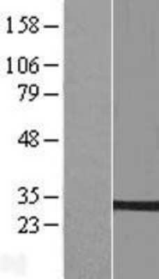 Western Blot: PTPLB Overexpression Lysate (Adult Normal) [NBL1-14966] Left-Empty vector transfected control cell lysate (HEK293 cell lysate); Right -Over-expression Lysate for PTPLB.