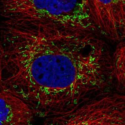Immunocytochemistry/ Immunofluorescence PTPMT1 Antibody - BSA Free