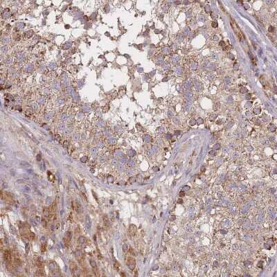 Immunohistochemistry-Paraffin: PTPMT1 Antibody [NBP2-13827] - Staining of human testis shows positivity in Leydig cells and ells in seminiferous ducts.