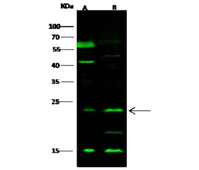 Western Blot: PTPMT1 Antibody [NBP3-00056] - Anti-PTPMT1 rabbit polyclonal antibody at 1:500 dilution. Lane A: 293T Whole Cell Lysate. Lane B: K562 Whole Cell Lysate. Lysates/proteins at 30 ug per lane. Secondary Goat Anti- Rabbit IgG H&L (Dylight 800) at 1/10000 dilution. Developed using the Odyssey technique. Performed under reducing conditions. Predicted band size: 23 kDa. Observed band size: 26 kDa (We are unsure as to the identity of these extra bands).