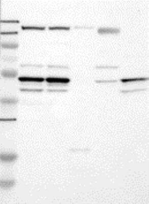 Western Blot: PTPN1 Antibody [22280002] - Samples:   Lane 1, Marker [kDa]: 250, 130, 95, 72, 55, 36, 28, 17, 11  Lane 2, RT-4  Lane 3, U-251MG sp Lane 4, Human Plasma  Lane 5, Liver  Lane 6, Tonsil, Target weight 50 kDa.