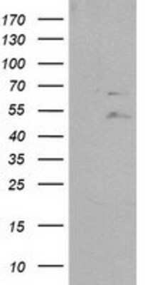 Western Blot: PTPN11/SHP2 Antibody (3F2) [NBP2-03063] - HEK293T cells were transfected with the pCMV6-ENTRY control (Left lane) or pCMV6-ENTRY PTPN11/SHP2 (Right lane) cDNA for 48 hrs and lysed. Equivalent amounts of cell lysates (5 ug per lane) were separated by SDS-PAGE and immunoblotted with anti-PTPN11/SHP2.