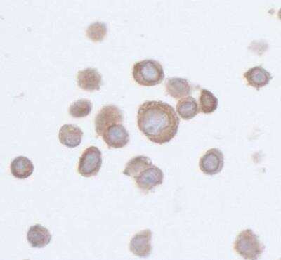 Immunocytochemistry/Immunofluorescence: PTPN12 Antibody (BL-5-2F8) [NBP2-76395] - Detection of human PTPN12 in FFPE SW620 cells by ICC. Antibody: Rabbit anti-PTPN12 recombinant monoclonal [BL-5-2F8] (NBP2-76395). Secondary: HRP-conjugated goat anti-rabbit IgG. Substrate: DAB.