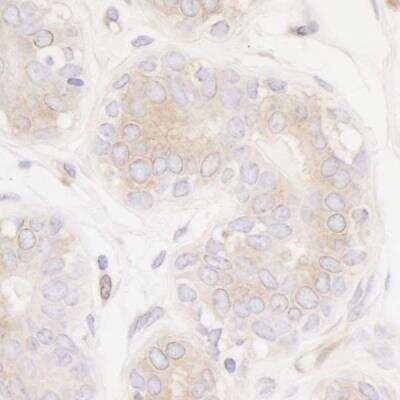 Immunohistochemistry: PTPN12 Antibody (BL-5-2F8) [NBP2-76395] - Detection of human PTPN12 in FFPE mammary gland by IHC. Antibody: Rabbit anti-PTPN12 recombinant monoclonal [BL-5-2F8] (NBP2-76395). Secondary: HRP-conjugated goat anti-rabbit IgG. Substrate: DAB.