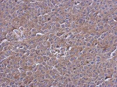 Immunohistochemistry-Paraffin: PTPN12 Antibody [NBP2-20004] - Immunohistochemical analysis of paraffin-embedded D54 xenograft, using antibody at 1:500 dilution.