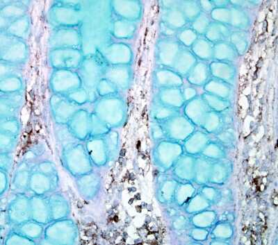 Immunohistochemistry-Paraffin: PTPN12 Antibody [NBP2-20004] - Immunohistochemical analysis of paraffin-embedded human ulcerative colitis tissue using PTPN12 antibody.