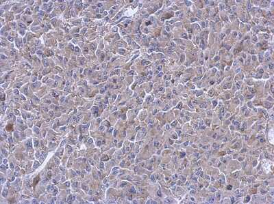 Immunohistochemistry-Paraffin: PTPN12 Antibody [NBP2-20004] - Immunohistochemical analysis of paraffin-embedded RT2 xenograft, using antibody at 1:500 dilution.