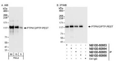 <b>Independent Antibodies Validation. </b>Western Blot: PTPN12 Antibody [NB100-60664] - Whole cell lysate from HeLa cells. PTPN12/PTPPEST was also immunoprecipitated by rabbit anti-PTPN12/PTPPEST antibodies NB100-60663, NB100-60665, and NB100-60666.