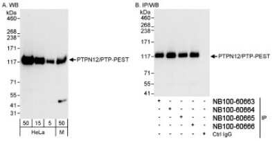 Western Blot: PTPN12 Antibody [NB100-60666] - Detection of Human and Mouse PTPN12/PTP-PEST on HeLa whole cell lysate using NB100-60666. PTPN12/PTPPEST was also IPed by NB100-60663, NB100-60664, and NB100-60665.