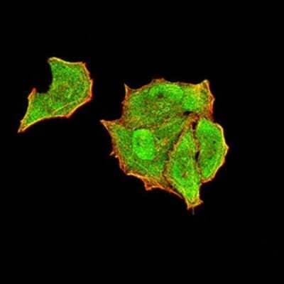 Immunocytochemistry/Immunofluorescence: PTPN14/PTPD2 Antibody (2C12E3) [NBP2-61810] - Analysis of Hela cells using PTPN14 mouse mAb (green). Blue: DRAQ5 fluorescent DNA dye. Red: Actin filaments have been labeled with Alexa Fluor- 555 phalloidin. Goat anti-Mouse IgG (H+L) DyLight 488 secondary antibody was used. 