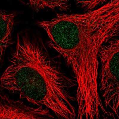 <b>Orthogonal Strategies Validation. </b>Immunocytochemistry/Immunofluorescence: PTPN14/PTPD2 Antibody [NBP2-38712] - Staining of human cell line HeLa shows localization to nucleoplasm. Antibody staining is shown in green.