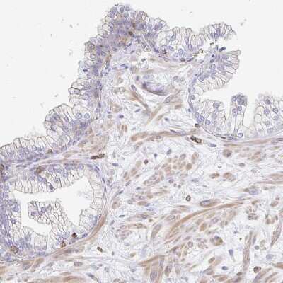 Immunohistochemistry-Paraffin: PTPN14/PTPD2 Antibody [NBP2-38712] - Staining of human prostate shows weak cytoplasmic positivity in smooth muscle cells.