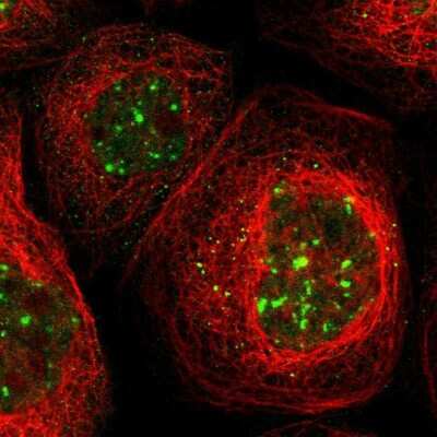 Immunocytochemistry/ Immunofluorescence PTPN23 Antibody