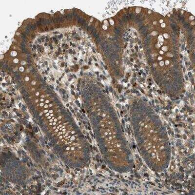 Immunohistochemistry-Paraffin: PTPN23 Antibody [NBP1-84158] - Staining of human appendix shows cytoplasmic positivity in glandular cells.