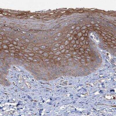 Immunohistochemistry-Paraffin PTPN3 Antibody