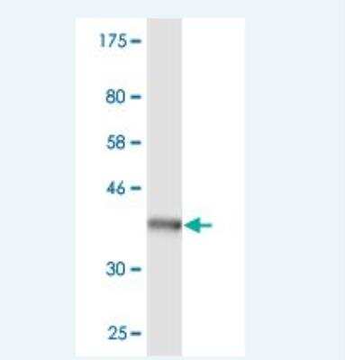 Western Blot PTPN4 Antibody (2C8)