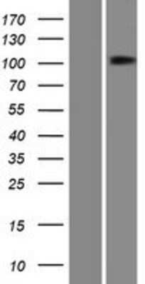 Western Blot: PTPN4 Overexpression Lysate (Adult Normal) [NBP2-08068] Left-Empty vector transfected control cell lysate (HEK293 cell lysate); Right -Over-expression Lysate for PTPN4.