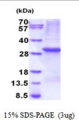 SDS-Page: PTPN4 Recombinant Protein [NBP2-52011] - 15% SDS Page (3 ug)