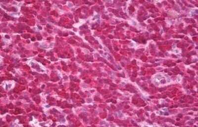 Immunohistochemistry-Paraffin: PTPN7 Antibody (AFPK32) [NBP2-11537] - Analysis of anti-PTPN7 antibody with human tonsil at dilution 1:200.