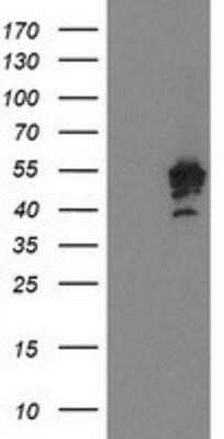 Western Blot: PTPN7 Antibody (OTI3B10) - Azide and BSA Free [NBP2-73732] - HEK293T cells were transfected with the pCMV6-ENTRY control (Left lane) or pCMV6-ENTRY PTPN7 (Right lane) cDNA for 48 hrs and lysed. Equivalent amounts of cell lysates (5 ug per lane) were separated by SDS-PAGE and immunoblotted with anti-PTPN7.